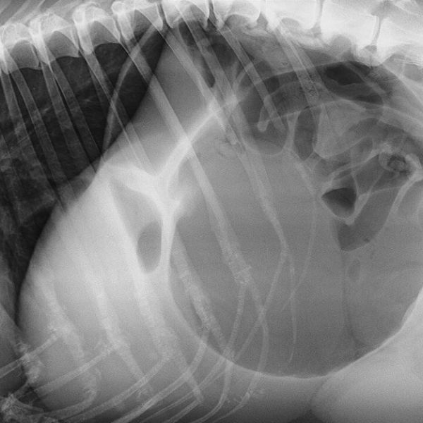 Torsión de Estómago Torsión de Estómago