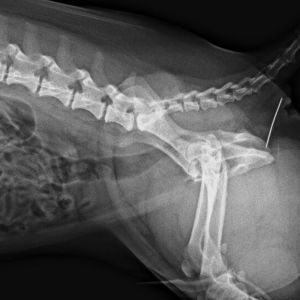 Cuerpo Extraño Rectal Cuerpo Extraño Rectal