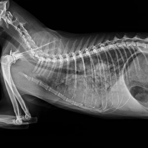 Patrón intersticial Patrón intersticial